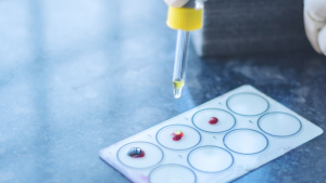 Scientists discover 48th blood group after 15 years of research: What ‘Gwada Negative’ means for the world