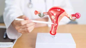 Ovarian Cancer: Your Diet and Lifestyle Guide to Thriving During and After Treatment