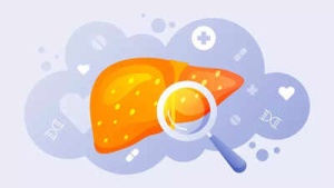 Simple Blood Test Offers Early Warning of Liver Damage, Years Before Symptoms