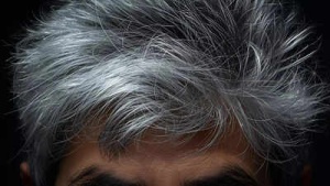 Vitamin Deficiency Linked to Premature Gray Hair: What You Need to Know
