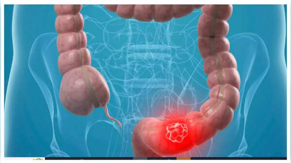 Illustration showing abdominal pain and discomfort.