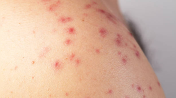 Red spots on skin