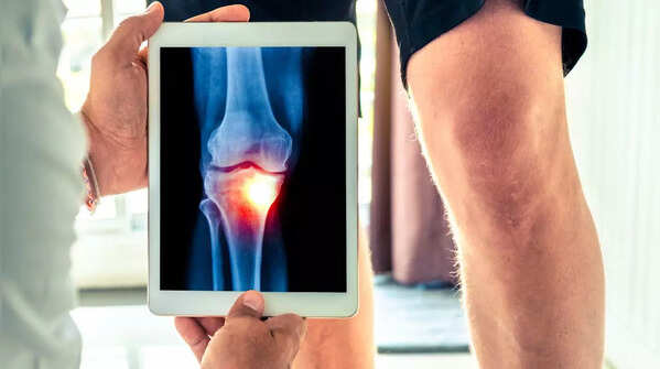 People with recent surgery or acute injuries