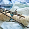 Risks and considerations