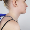 A small hump forming on the upper back