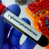 GGT (Gamma- Glutamyl transferase)
